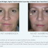 Ageloc Future Serum - Afbeelding 2